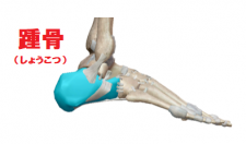踵骨