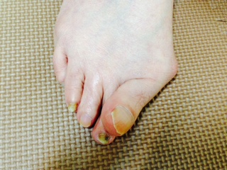 gai1
